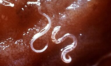 What are the parasites in the liver in people